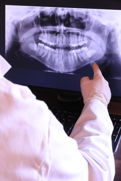 Best Emergency Treatment for Dental Infections or Abscesses in Marlboro, NY