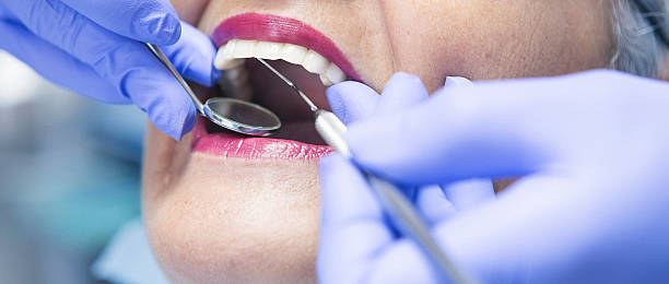Best Emergency Dental Care for Broken or Chipped Teeth in Marlboro, NY